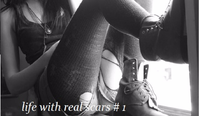 ” Life with real scars” -prolog.