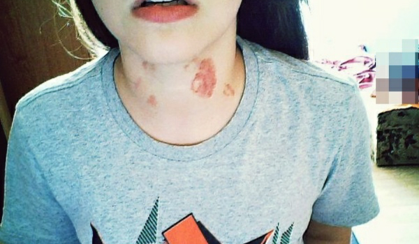 Czy robisz.dobre malinki