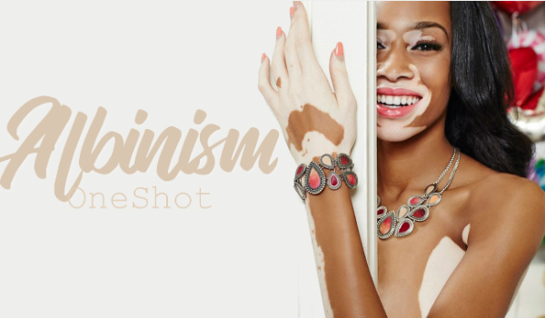 Albinism OneShot