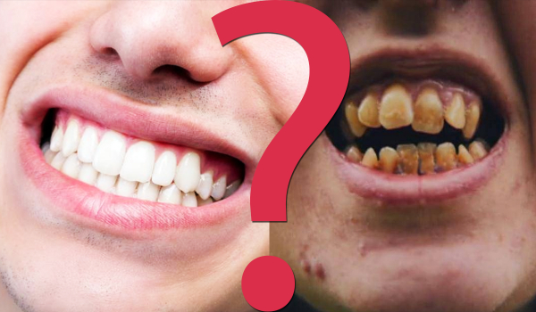 13 odpychających pytań z serii „Co wolisz”?, na które nie chcesz odpowiedzieć!