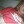 _xnat._alia_x_