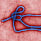 .Ebola.