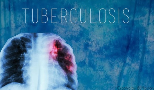 Tuberculosis- cz 1