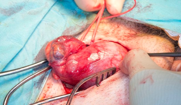 Jak dobrze liżesz stupki