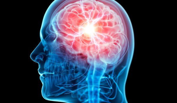 Czy jesteś zjebany?