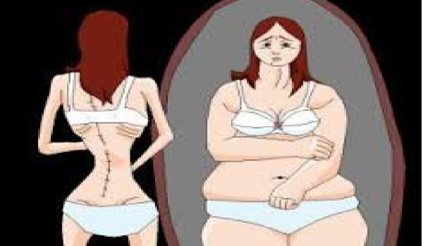Anoreksja Bulimiczna