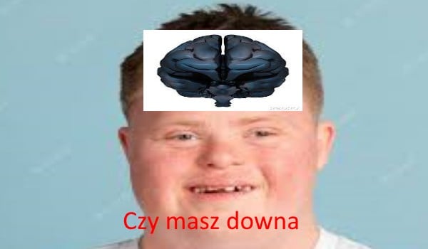 Czy masz downa