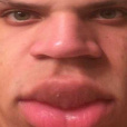3_Debil_3